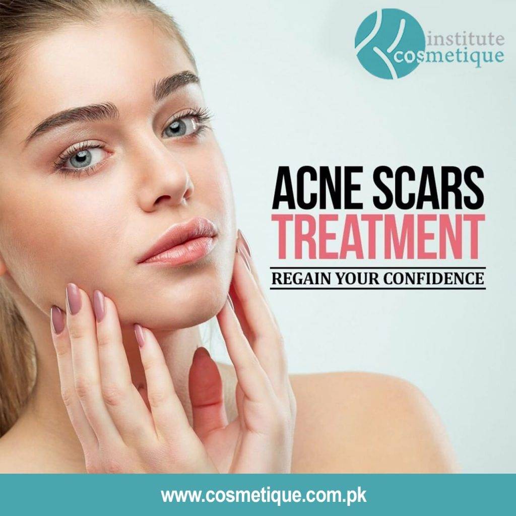 Acne Scars treatment in Lahore, Pakistan